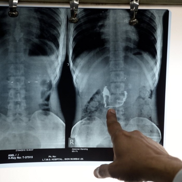 Indranil Mukerjee/AFP