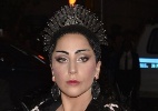 O que Lady Gaga e Astrid têm em comum? Veja famosos portadores de lúpus - Justin Lane/EFE