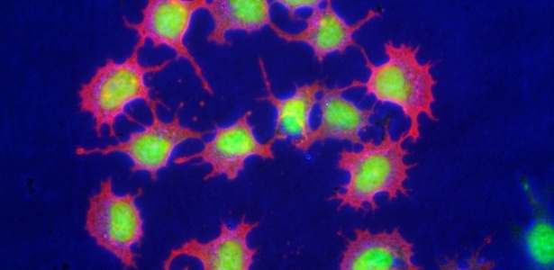 Os pesquisadores identificaram condições de cultivo que permitem o desenvolvimento de um novo tipo especial de célula-tronco - Mpi Muenster/dpa/Corbis