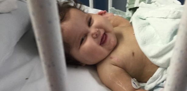 A bebê Sofia Gonçalves de Lacerda, em foto tirada antes da cirurgia realizada em maio - Arquivo Pessoal