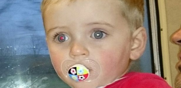 Uma foto de celular ajudou Stacey Sutherland a diagnosticar seu filho Zak com um tipo raro de tumor: retinoblastoma - Reprodução/"Newcastle Chronicle"