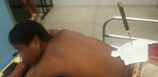 22.mai.2015 - Homem é socorrido no Hospital de Urgência de Teresina com uma faca encravada nas costas - Divulgação/Polícia Militar
