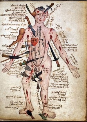 “Hombre Herido,” obra medieval atribuida a Galeno  - Wikimedia Commons