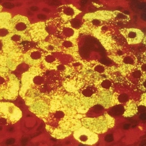 Células do pâncreas produtoras de insulina (em amarelo) - Xavier da Silva/ Revista Pesquisa Fapesp