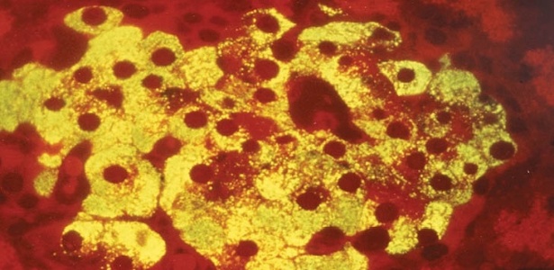 Células do pâncreas produtoras de insulina (amarelo): danificadas pelo sistema imune do feto na síndrome IPEX - Xavier da Silva/ Revista Pesquisa Fapesp
