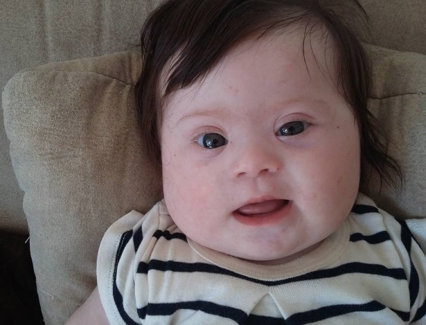 "Aqui está a minha garotinha, Louise. Ela tem quatro meses de idade, duas pernas, dois braços e um cromossomo extra", escreveu - Reprodução/Facebook