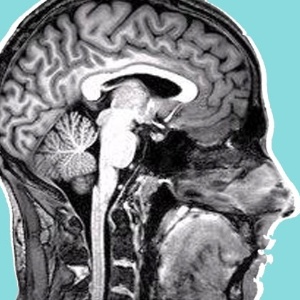 Arte sobre imagem de ressonância magnética do cérebro - Natalie Ma/Slate