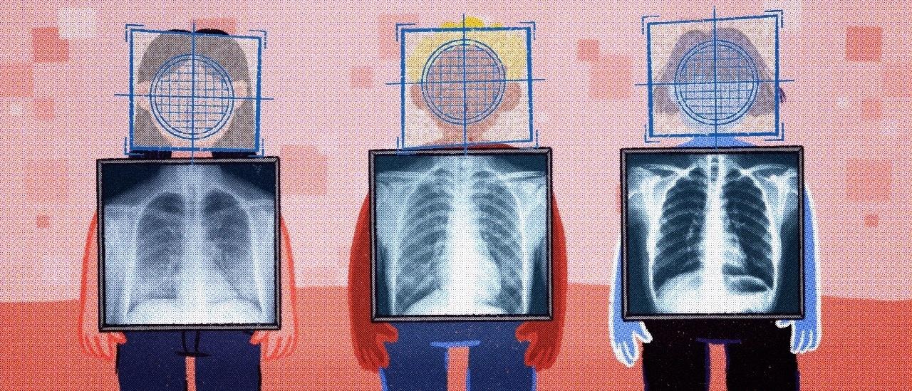 Como Algoritmos Podem Ajudar A Minimizar Impactos Do Coronavirus No Brasil 30 09 2020 Uol Tilt