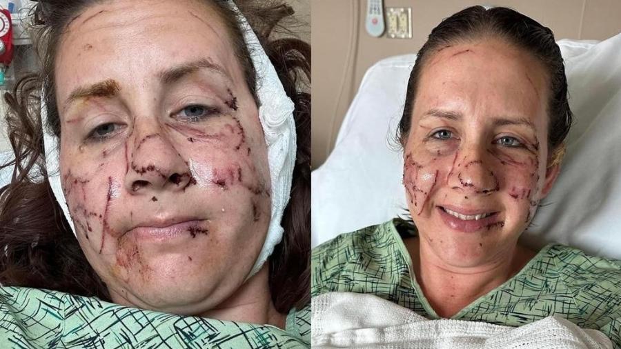 Jen Royce precisou ser hospitalizada após ataque de lontra em rio dos EUA