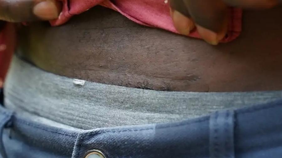 Amon Kipruto Mely: 'Se eu pudesse voltar no tempo, não teria aceitado a remoção do meu rim' Amon Kipruto Mely: 'Se eu pudesse voltar no tempo, não teria aceitado a remoção do meu rim'