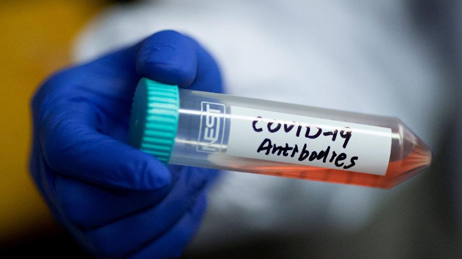 Cientista mostra tubo contendo anticorpos para covid-19 - THOMAS PETER