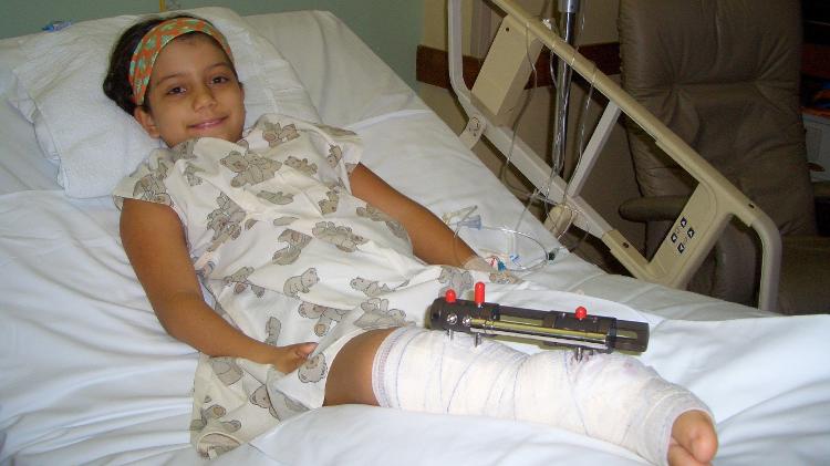 Giovanna passou por dez cirurgias Giovanna passou por dez cirurgias