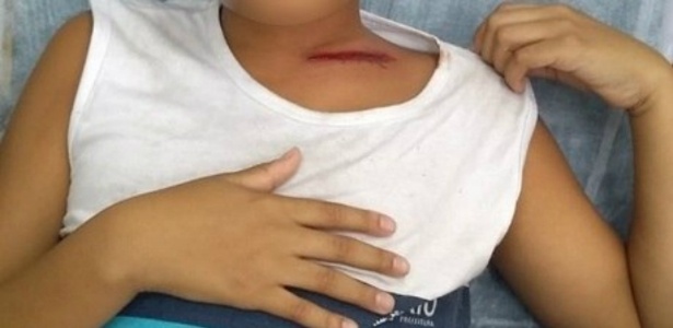 Estudante de 11 anos foi atingido de raspão na altura da clavícula em sala de aula - Reprodução/Twitter