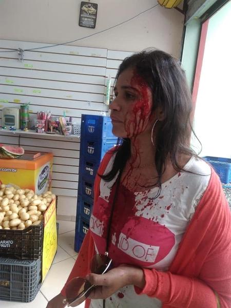 Bárbara Kelly dos Santos Dias, logo após a agressão que diz ter sofrido no brechó - Arquivo pessoal