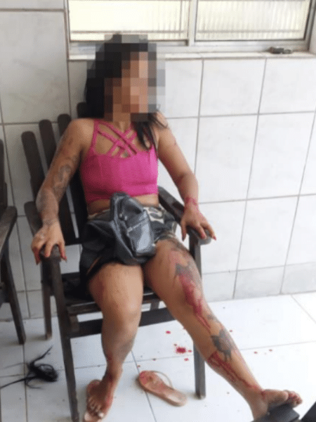 Mulher fez cortes de estilete em próprio corpo para fingir ameaças de morte