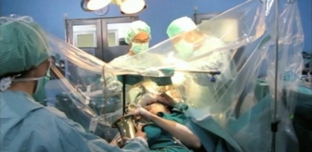 Paciente toca saxofone durante cirurgia no cérebro - Reprodução