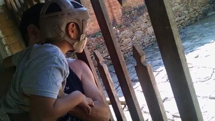 Vitor precisou usar um capacete especial para se proteger de quedas - Arquivo pessoal