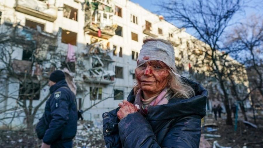 Mulher fica ferida em explosão de edifício durante ofensiva militar russa em Chuguiv, no leste da Ucrânia, na manhã de 24/2 - WOLFGANG SCHWAN/ANADOLU AGENCY VIA GETTY IMAGES