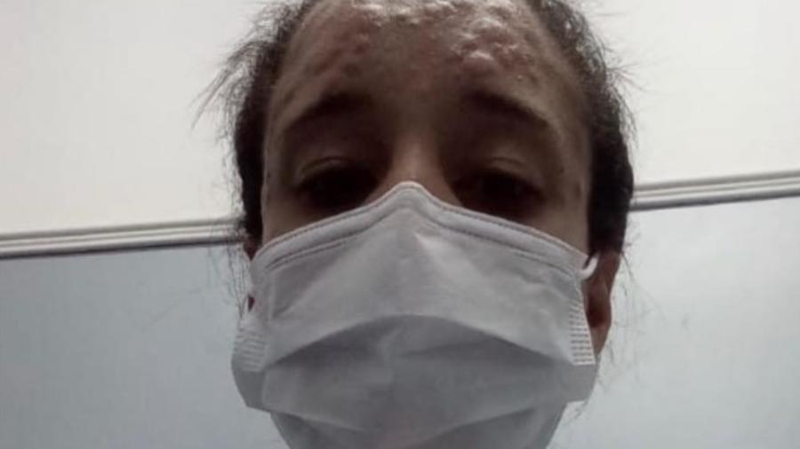 Paciente de Itaguaí (RJ) com suspeita de varíola dos macacos relata bolhas que não param de doer - Reprodução/Redes sociais
