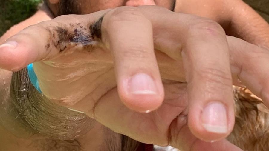 Charles Silva, 45, ficou com a mão suja com óleo na praia de Cupe, em Pernambuco - Arquivo Pessoal