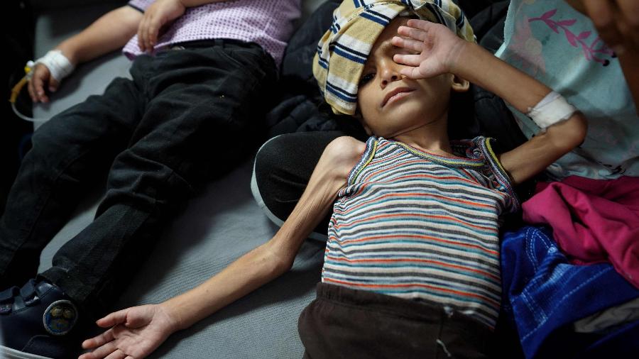 30.mai.2024 - Criança palestina recebe tratamento contra desnutrição no hospital Al-Aqsa, no centro da Faixa de Gaza