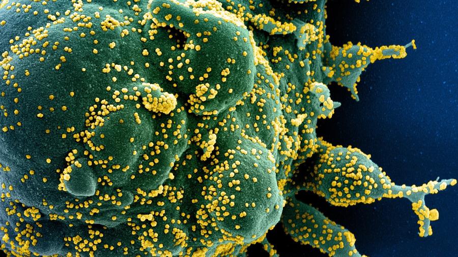 Micrografia eletrônica de uma célula (verde) fortemente infectada com partículas do vírus Sars-CoV-2 (amarelo), isolada de uma amostra de paciente - Instituto Nacional de Alergia e Doenças Infecciosas (NIAID, na sigla em inglês)