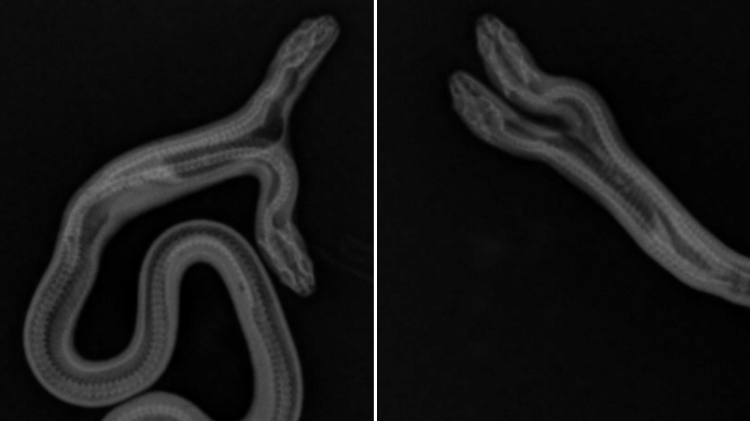 Imagens de raio-x mostram a estrutura do corpo da cobra; à direita, detalhe das duas cabeças Imagens de raio-x mostram a estrutura do corpo da cobra; à direita, detalhe das duas cabeças