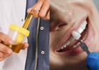 Dente de xixi? Implantes feitos com urina podem ser o futuro da odontologia (Foto: Freepik)