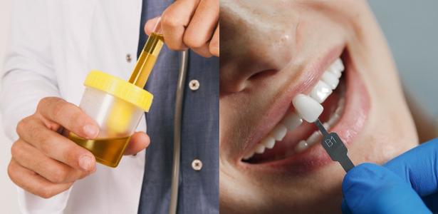 Dente de xixi? Implantes feitos com urina podem ser o futuro da odontologia