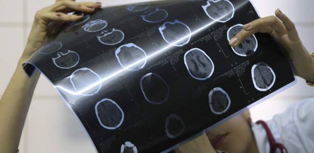 Médica examina tomografia de criança diagnosticada com microcefalia - Guga Matos/ JC Imagem/ AE