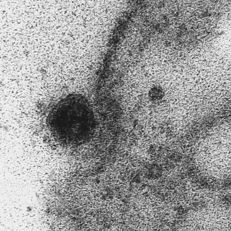 Imagem de microscopia mostra coronavírus atacando a membrana de uma célula - IOC/Fiocruz