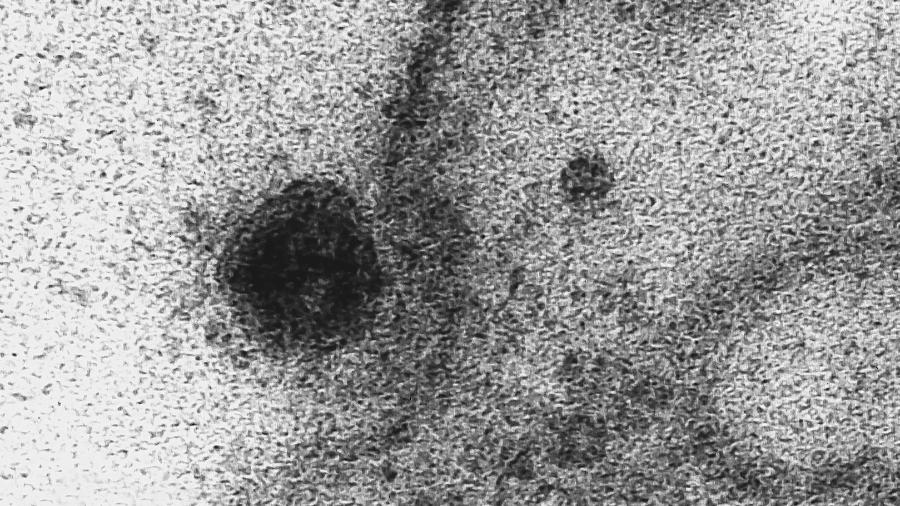 Imagem de microscopia mostra à esquerda o Sars-Cov-2, o novo coronavírus, atacando a membrana de uma célula - Débora Barreto/IOC/Fiocruz