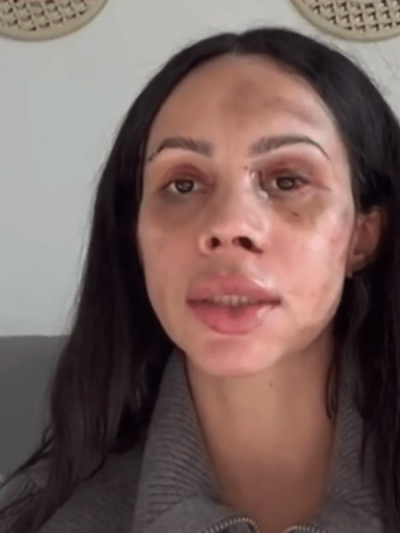 Maressa Nunes foi agredida no Chile 
