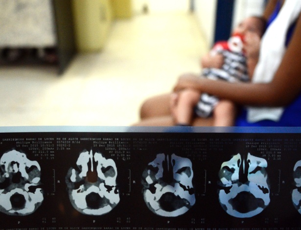Mãe segura bebê com microcefalia em hospital do Recife - Xinhua/Diego Herculano/Brazil Photo Press/Agência Estado