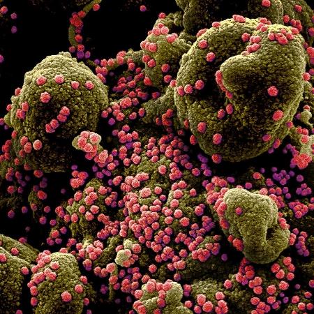 Imagens do NIAID (EUA) mostram células humanas sendo atacada pelo coronavírus responsável pela covid-19 - NIAID
