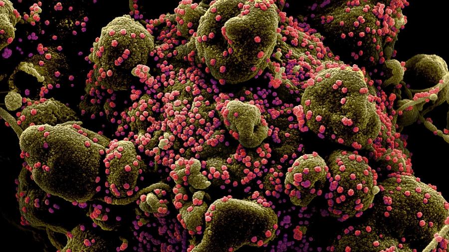 Vírus Sars-COV-2 (em rosa) infectam células humanas, que replicam material genético e morrem - NIAID