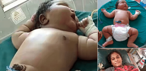 Bebê nasceu com peso esperado para uma criança de seis meses de idade - Reprodução/RaajjeTV/Twitter