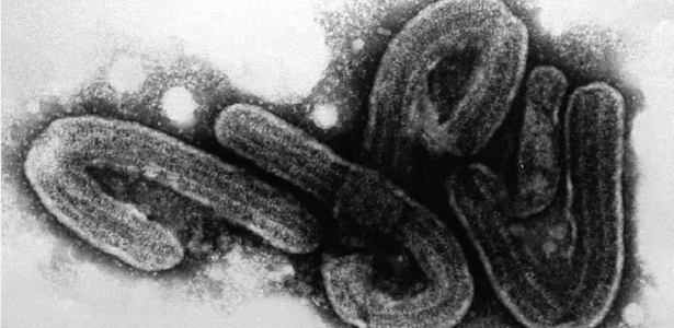 Visão de microscópio do vírus Marburg, o mais perigoso do mundo  - B/W
