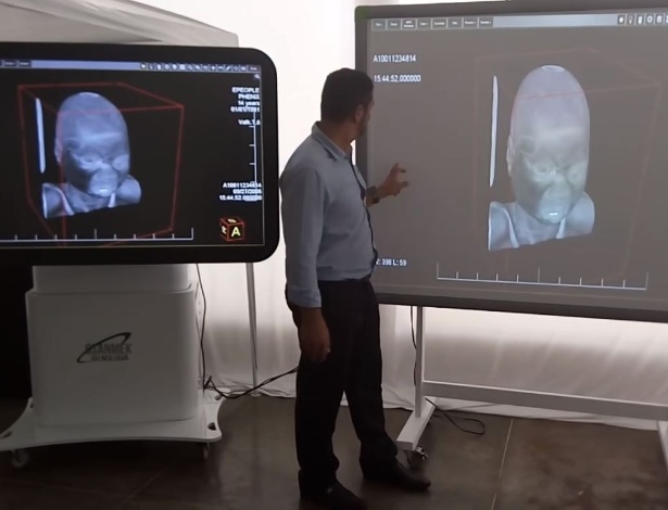 Start Up Brasileira Quer Trocar Cadáveres Por Tecnologia Em Aulas De