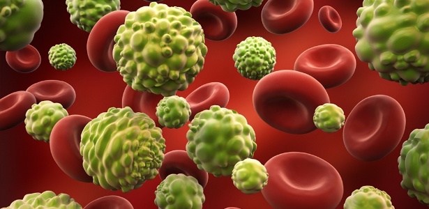 Células cancerígenas aparecem dentro de uma veia ao lado de células sanguíneas - iStock