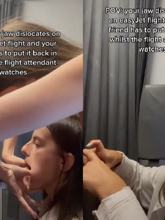 Estudante desloca mandíbula durante voo ao bocejar; veja o que fazer -  30/07/2022 - UOL VivaBem