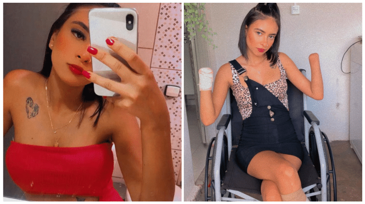 A jovem agora luta para se adaptar e conseguir arrecadar recursos para comprar as próteses de que necessita - Reprodução/Instagram - Reprodução/Instagram