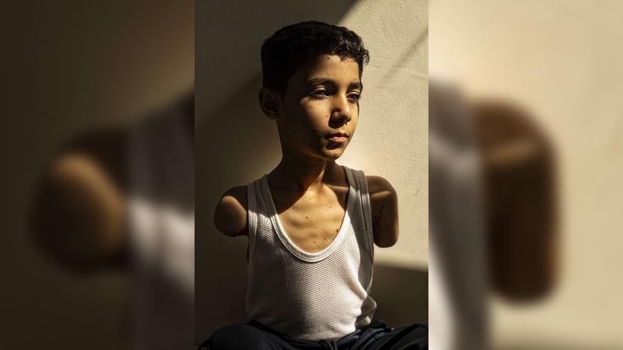Mahmoud Ajjour, de 9 anos - Samar Abu Elouf/The New York Times via World Press Photo