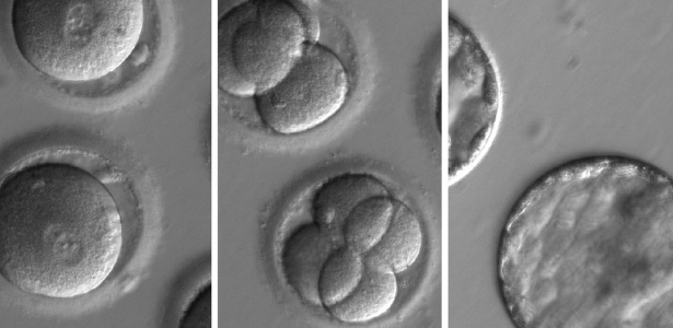 Fotos de embriões geneticamente modificados: cientistas conseguiram editar genes que causavam a cardiomiopatia hipertrófica a ser transmitida de pais para filhos - OHSU