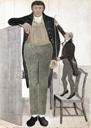 Byrne chegou a ganhar bastante dinheiro se apresentando para curiosos, mas acabou virando alcoólatra e morreu pobre - Science Photo Library