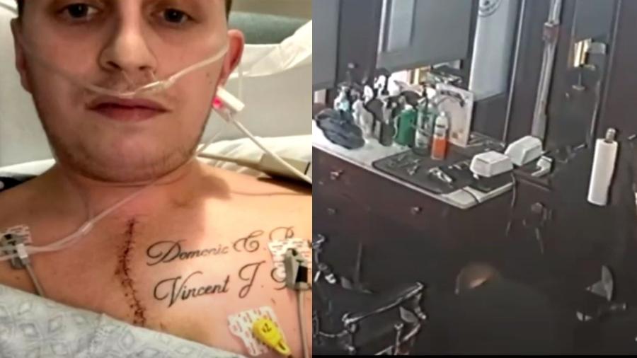 O barbeiro Steve Silva, de 29 anos, sofreu um acidente e perfurou o próprio peito com uma tesoura - Reprodução/CBS Boston