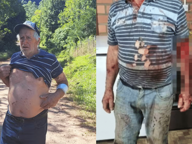 Homem é atacado por onça-parda em Maquiné, no interior do RS