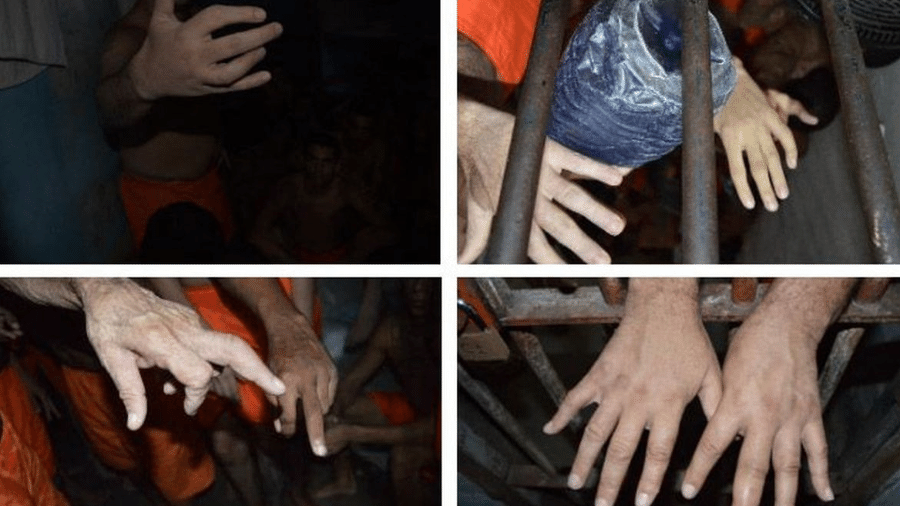 Dedos quebrados são um método de tortura ainda usados no Brasil