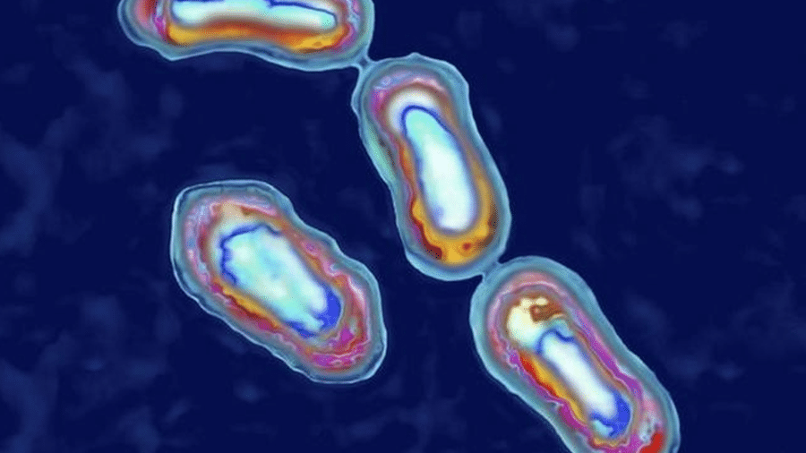 A peste pneumônica é causada pela bactéria Yersinia pestis - Getty Images
