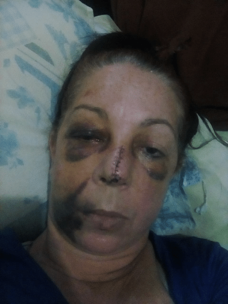 Liliane Monteiro, de 49 anos, afirmou que foi agredida por policiais militares, que alegaram que ela desacatou agentes - Reprodução/Arquivo Pessoal